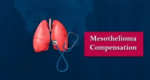 What is Mesothelioma and How to Get Mesothelioma Compensation ?